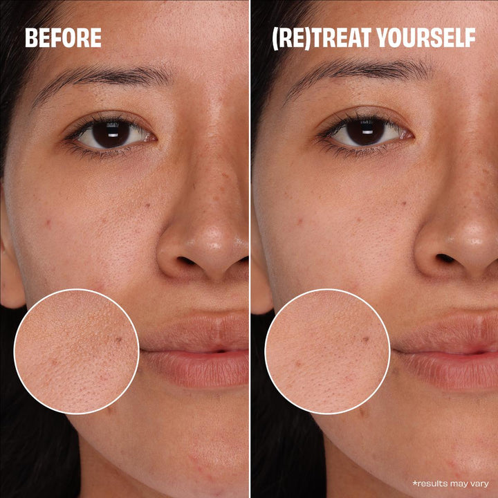 Porefessional Pore Care