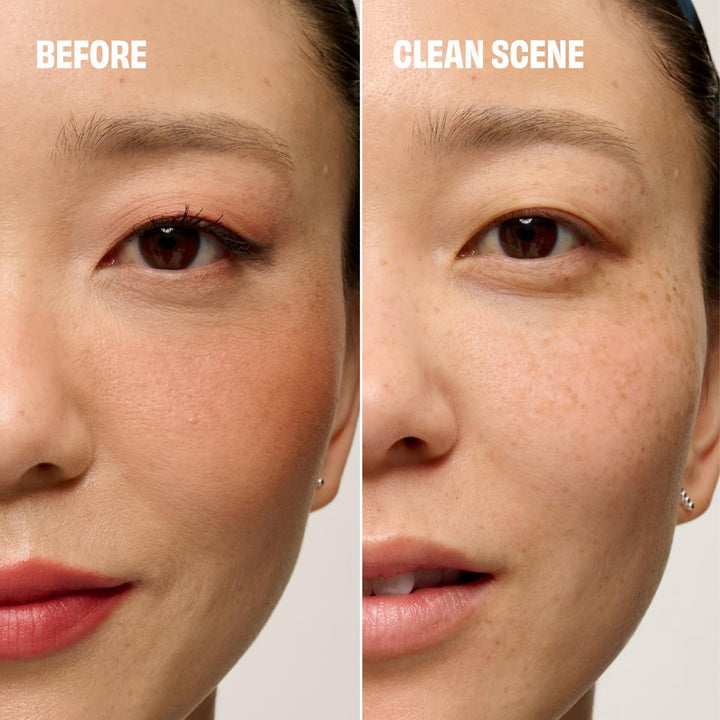 Porefessional Pore Care