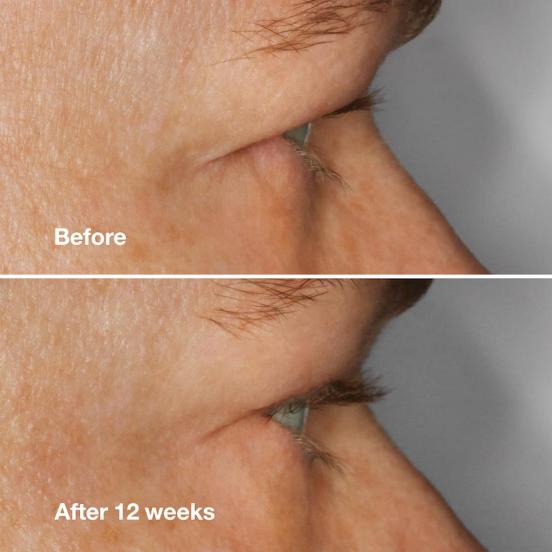 High Impact™ Lash Amplifying Serum