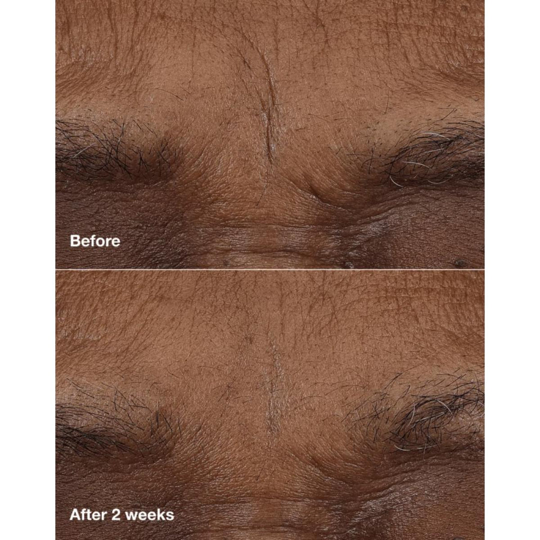 Smart Clinical Repair™ AM/PM Retinoid Balm