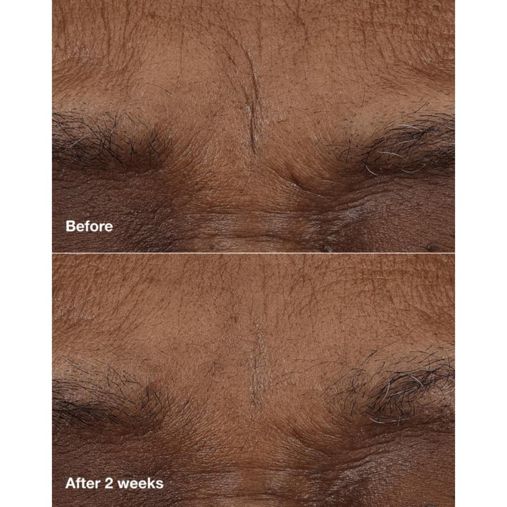 Smart Clinical Repair™ AM/PM Retinoid Balm