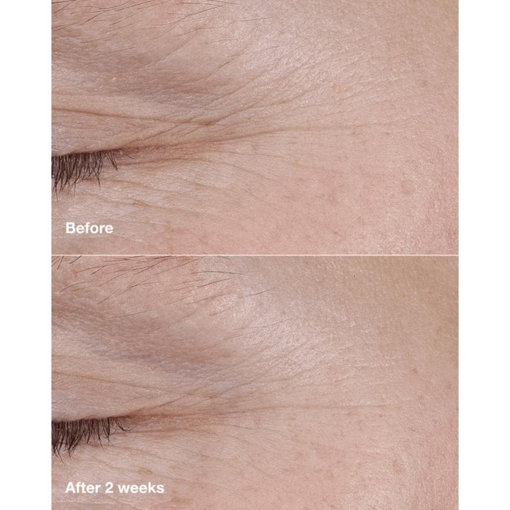 Smart Clinical Repair™ AM/PM Retinoid Balm