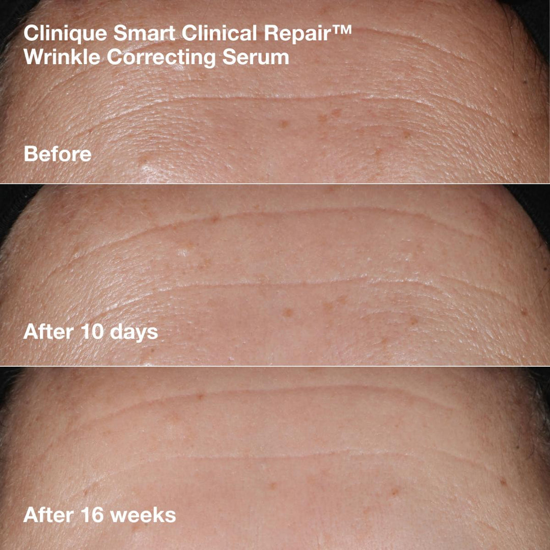 Wrinkle-Correcting Routine
