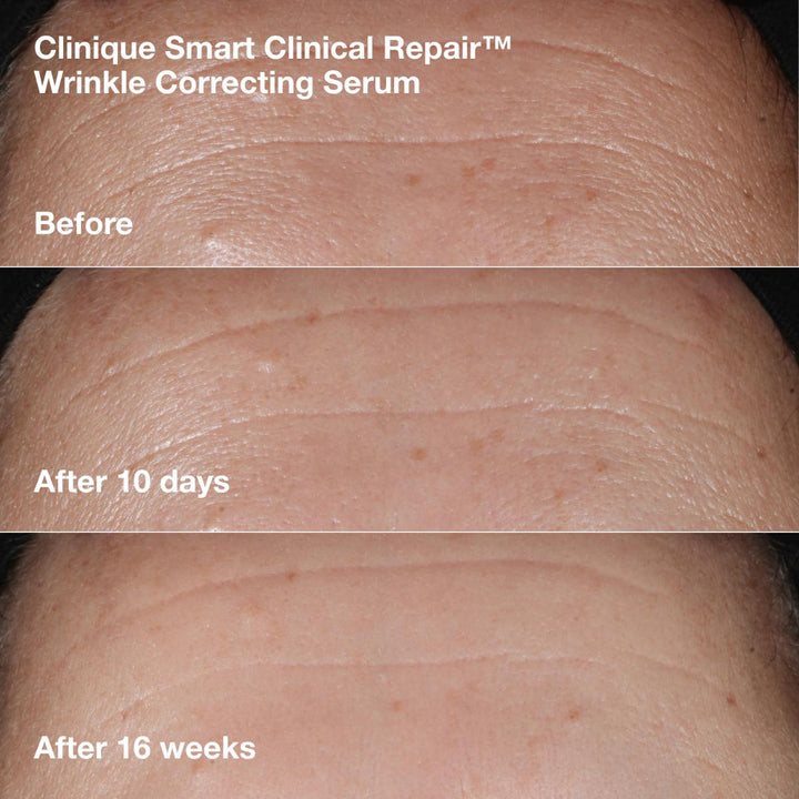 Wrinkle-Correcting Routine