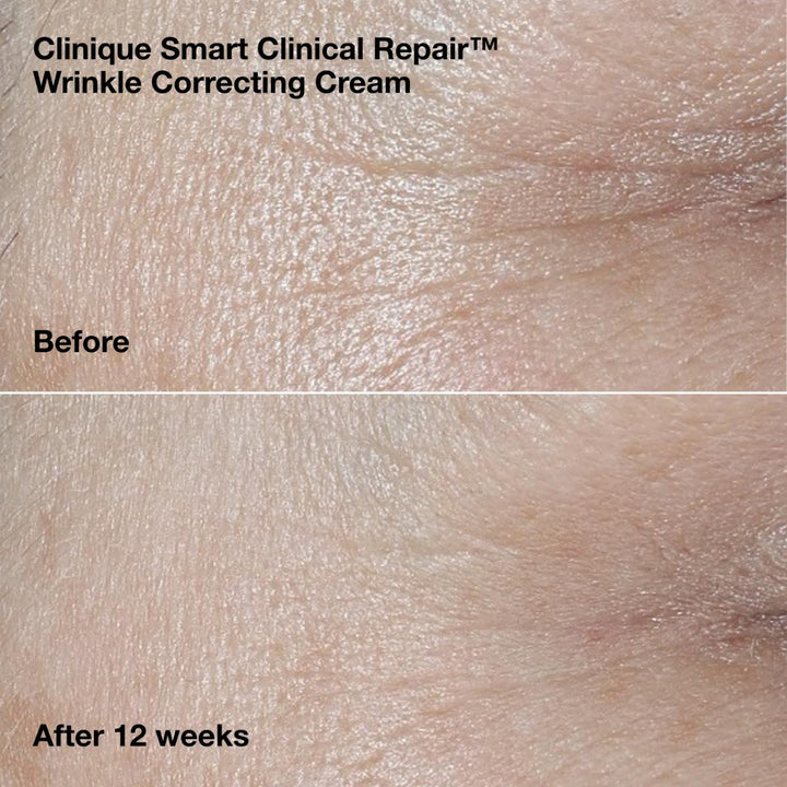 Wrinkle-Correcting Routine
