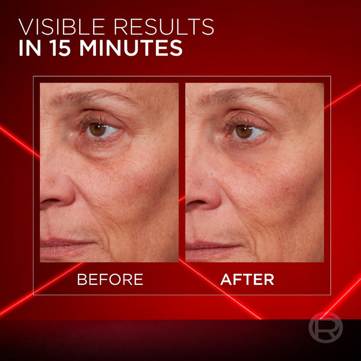 Revitalift Laser Instant Bag Eraser