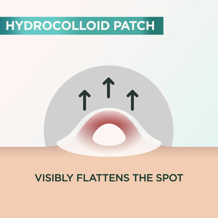 Pure Active Pimple Patches