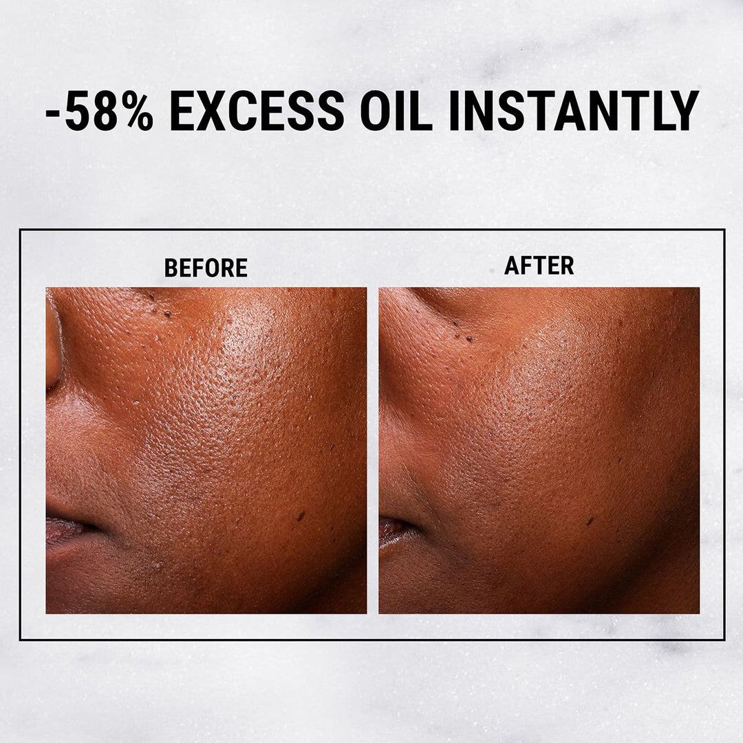 Ultra Pure High-Potency 5.0% Niacinamide Serum 30ml