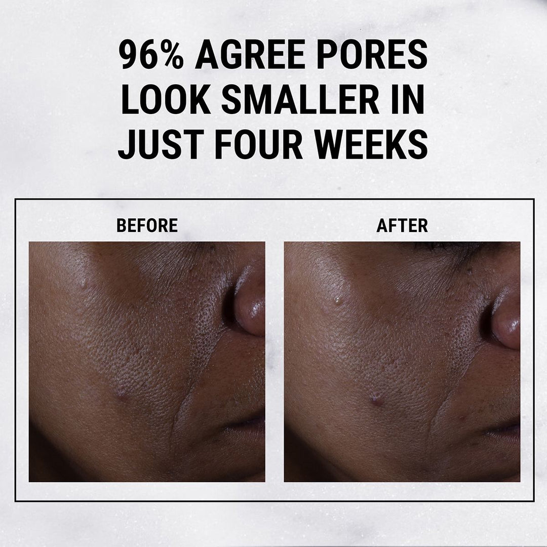 Ultra Pure High-Potency 9.8% Glycolic Acid Serum