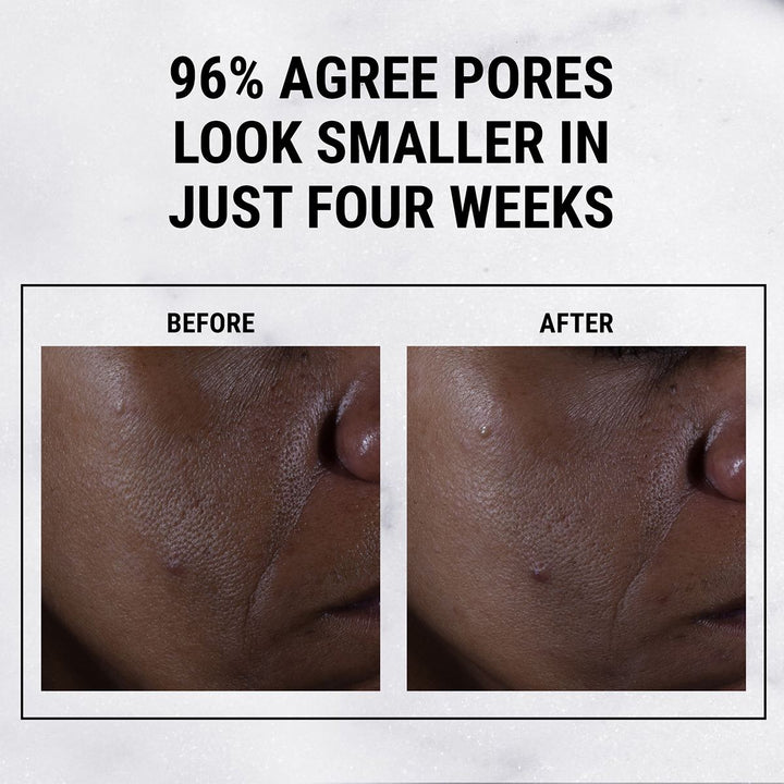 Ultra Pure High-Potency 9.8% Glycolic Acid Serum