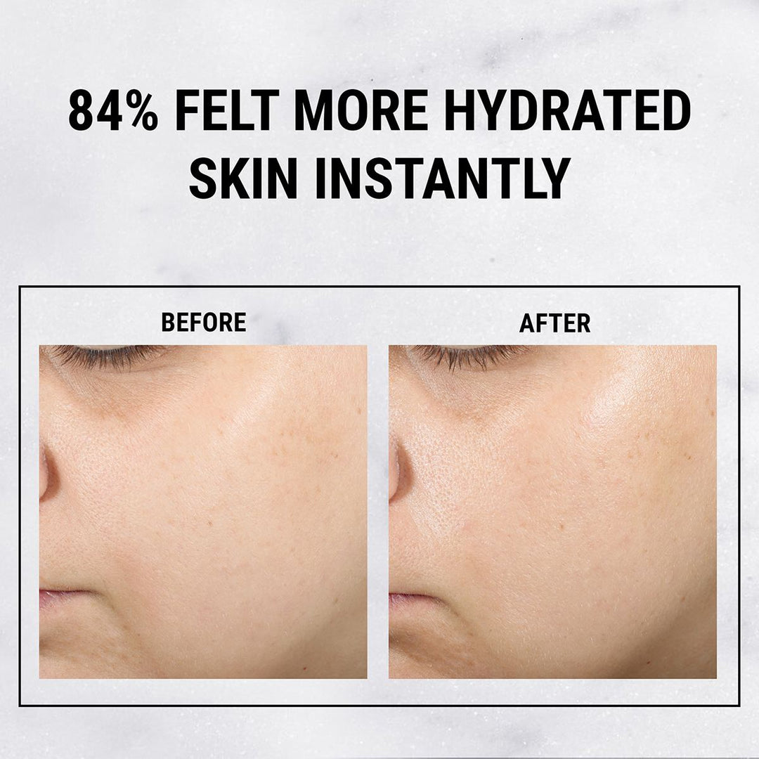 Ultra Pure High-Potency 1.5% Hyaluronic Acid Serum 30ml