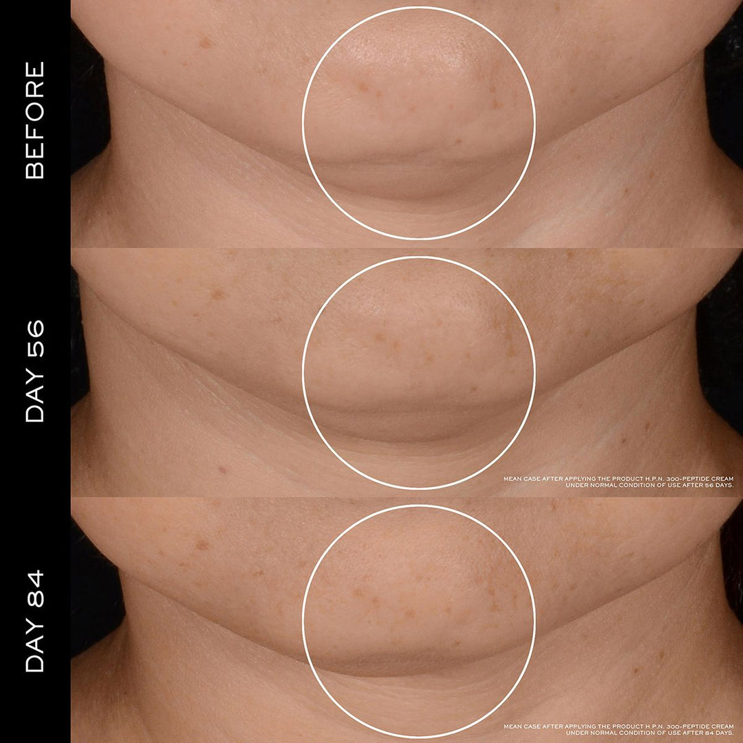 Renêrgie Peptide Cream