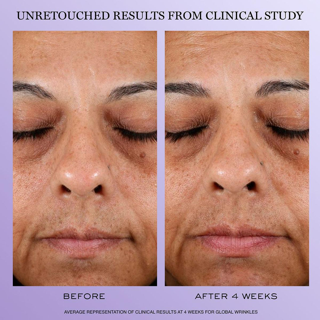 Regenerie Multi-Lift Routine Set