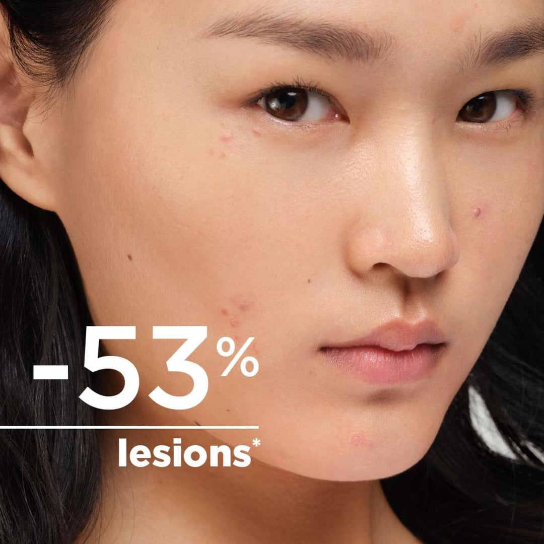 Sébium Kerato+ Moisturiser