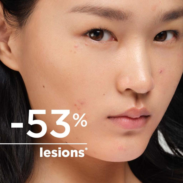 Sébium Kerato+ Moisturiser