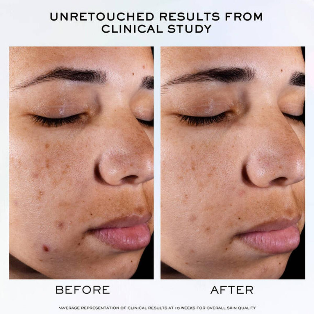 Clarifique Pro-Solution Serum