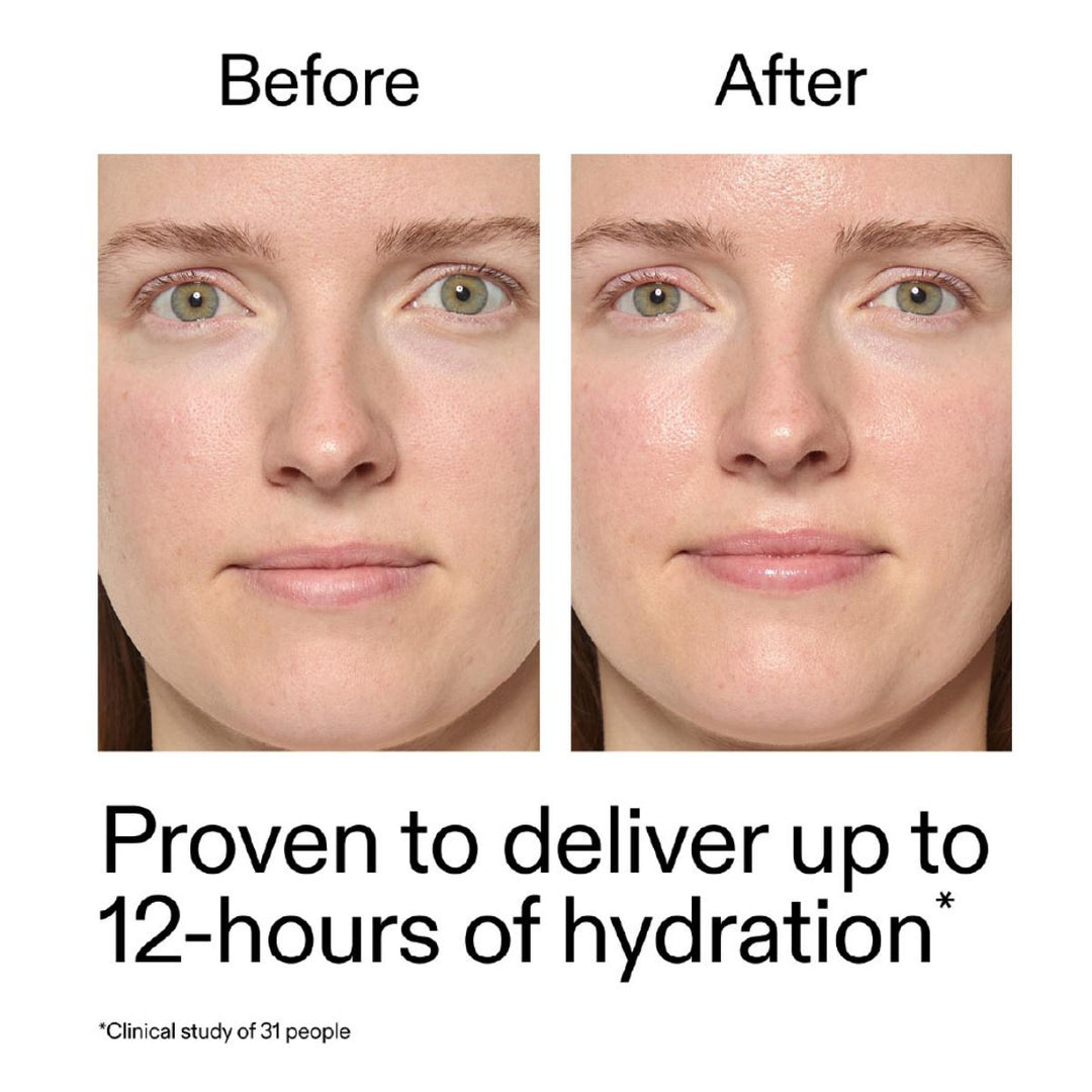 Exosome Hydro-Glow Complex