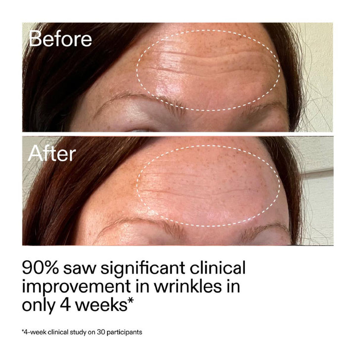 Starter Retinol Serum
