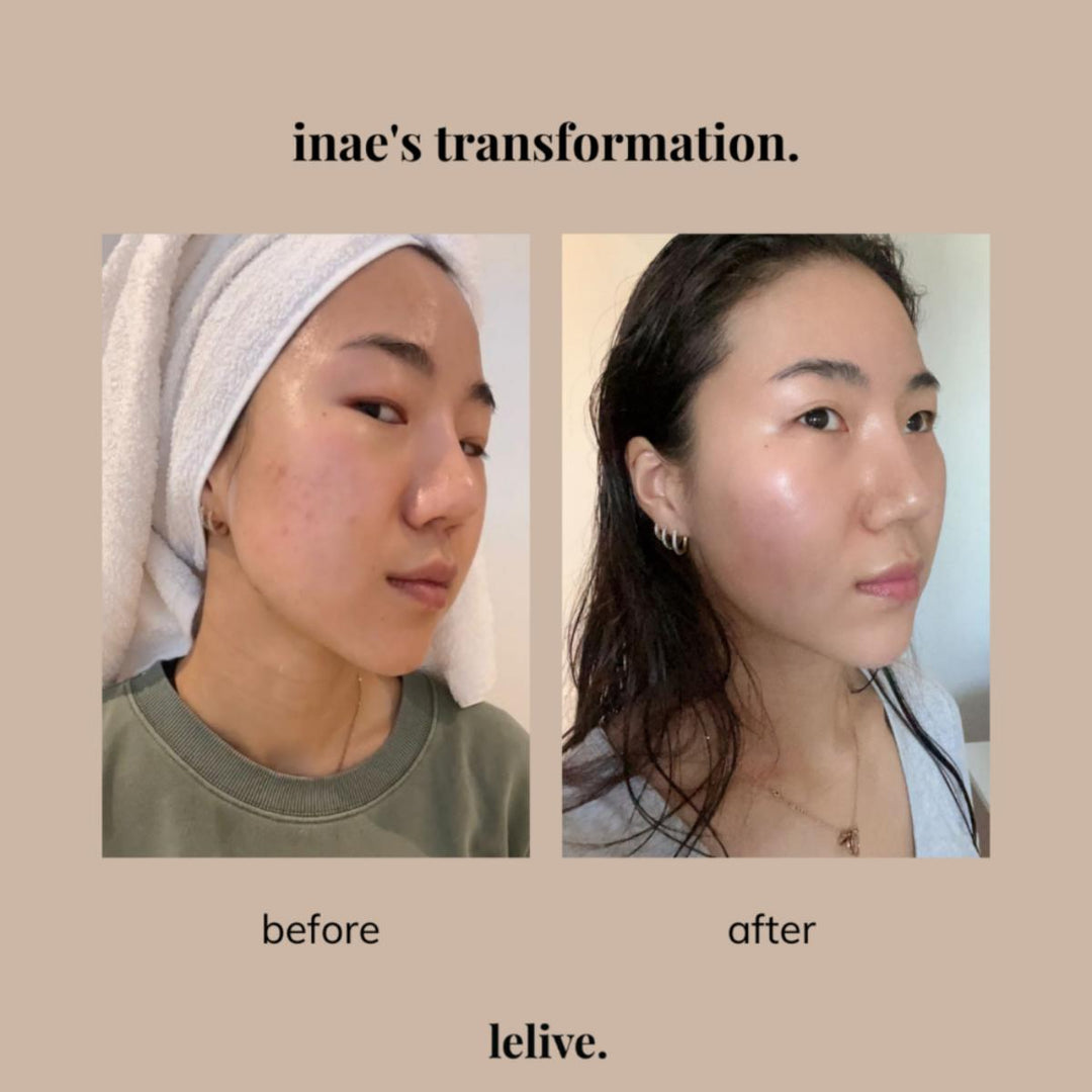 Save Our Skin (SOS) - Exfoliating & Control Serum