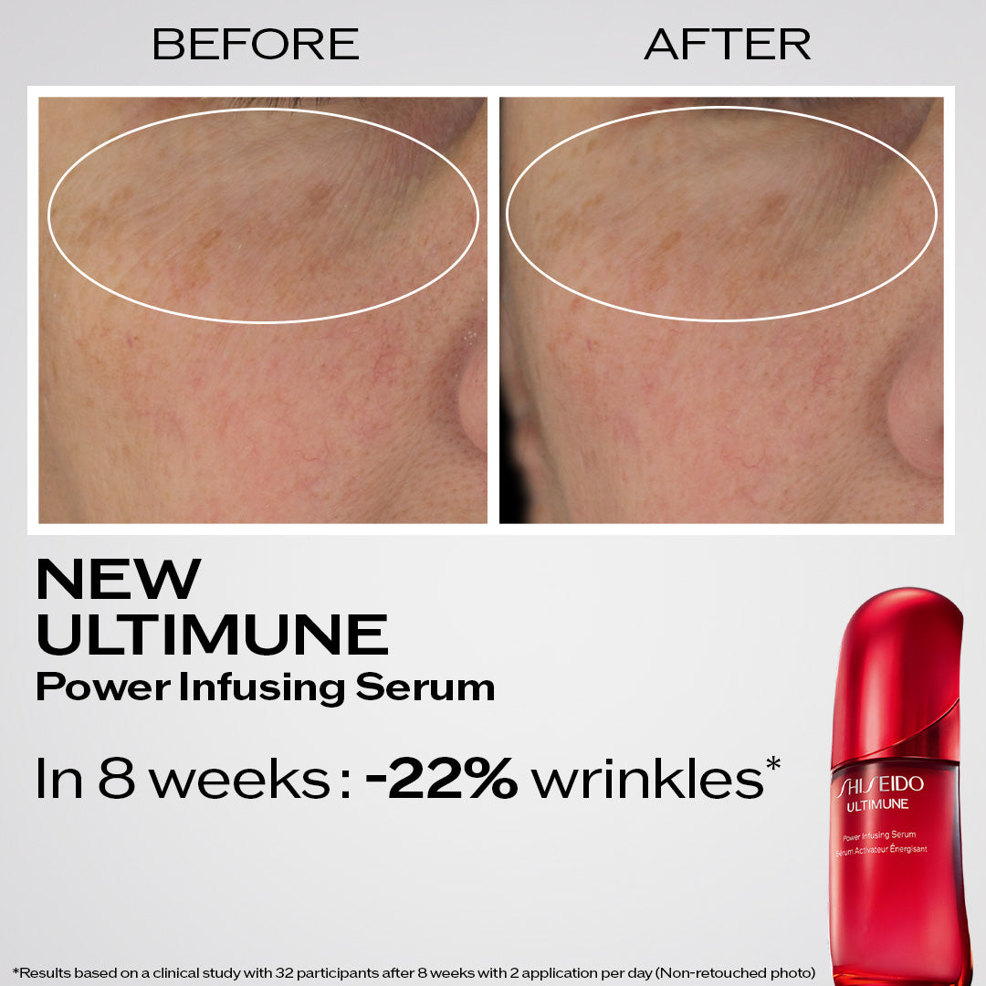 Ultimune Power Infusing Serum