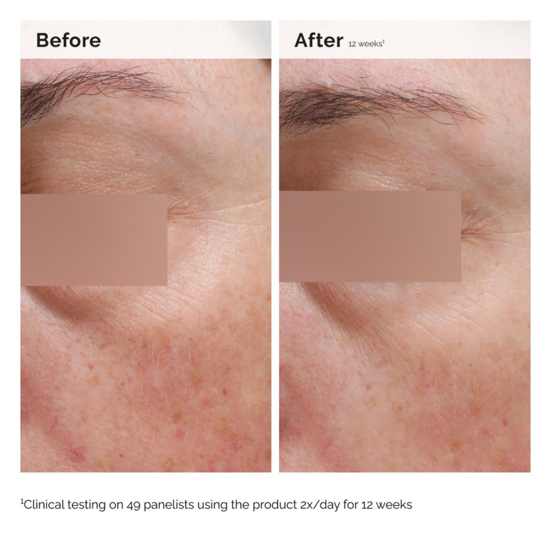 Niacinamide 5 Face Body Emulsion | The Ordinary