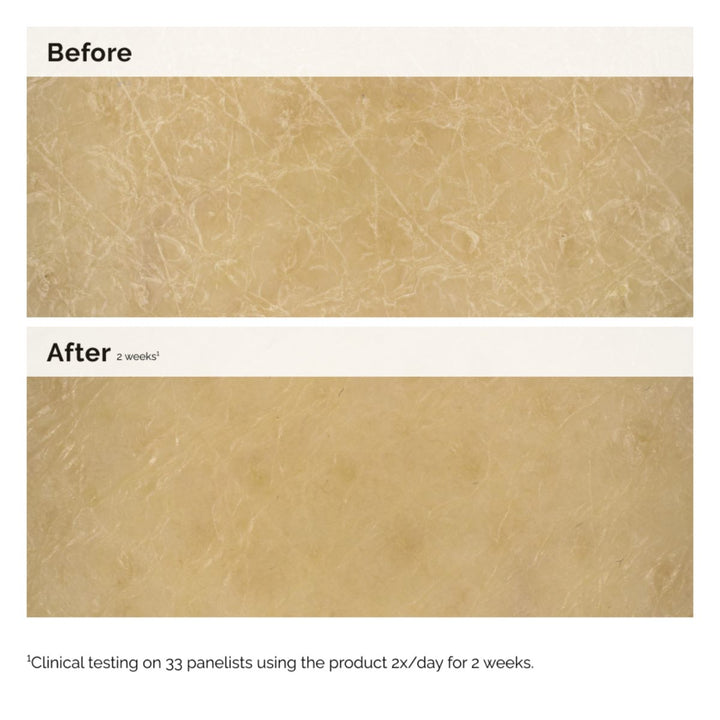 Natural Moisturizing Factor + Inulin Body Lotion | The Ordinary