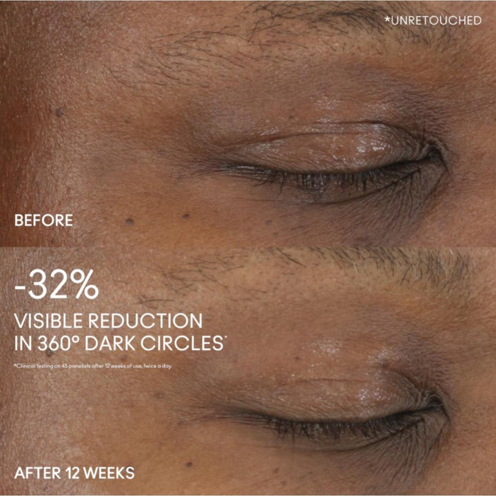 Hyper Real Eye Serumizer - 15ml