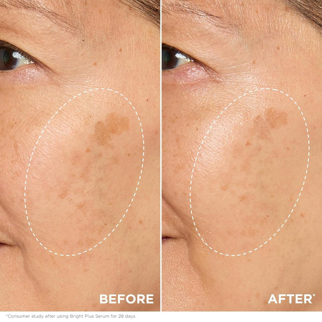 Bright Plus Advanced Serum