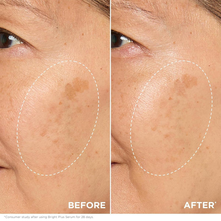 Bright Plus Advanced Serum