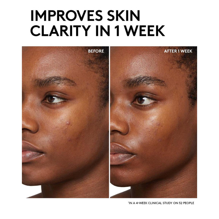 Cherry Dub BHA Toner with Salicylic Acid + Aloe Juice