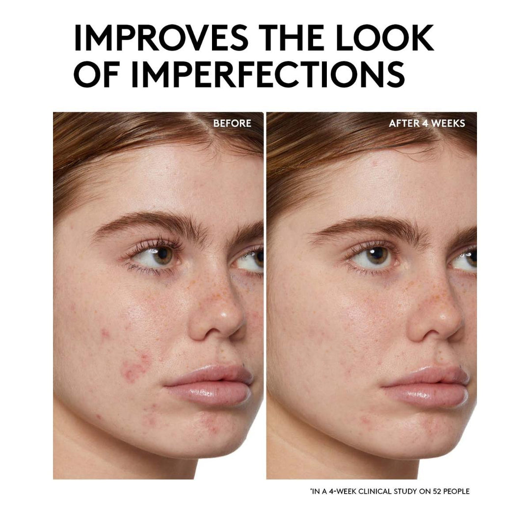 Cherry Dub BHA Toner with Salicylic Acid + Aloe Juice