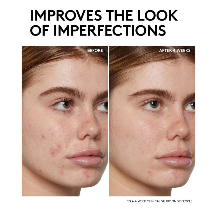 Cherry Dub BHA Toner with Salicylic Acid + Aloe Juice