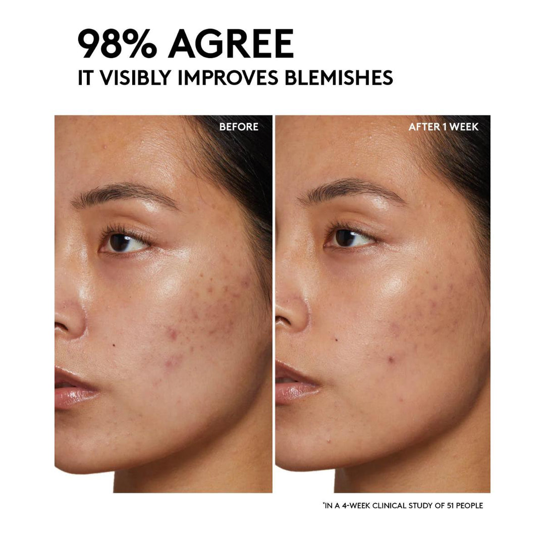 Cherry Dub Pore Purify'r Gel Cleanser with Niacinamide + Aloe Juice