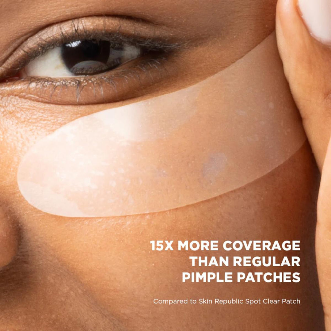 XL Spot Clear Patch (10 Patches)