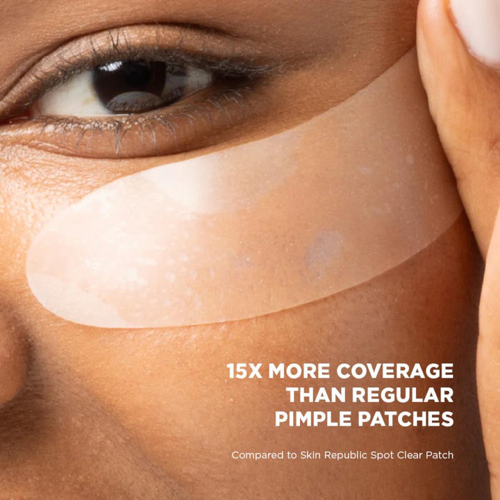 XL Spot Clear Patch (10 Patches)