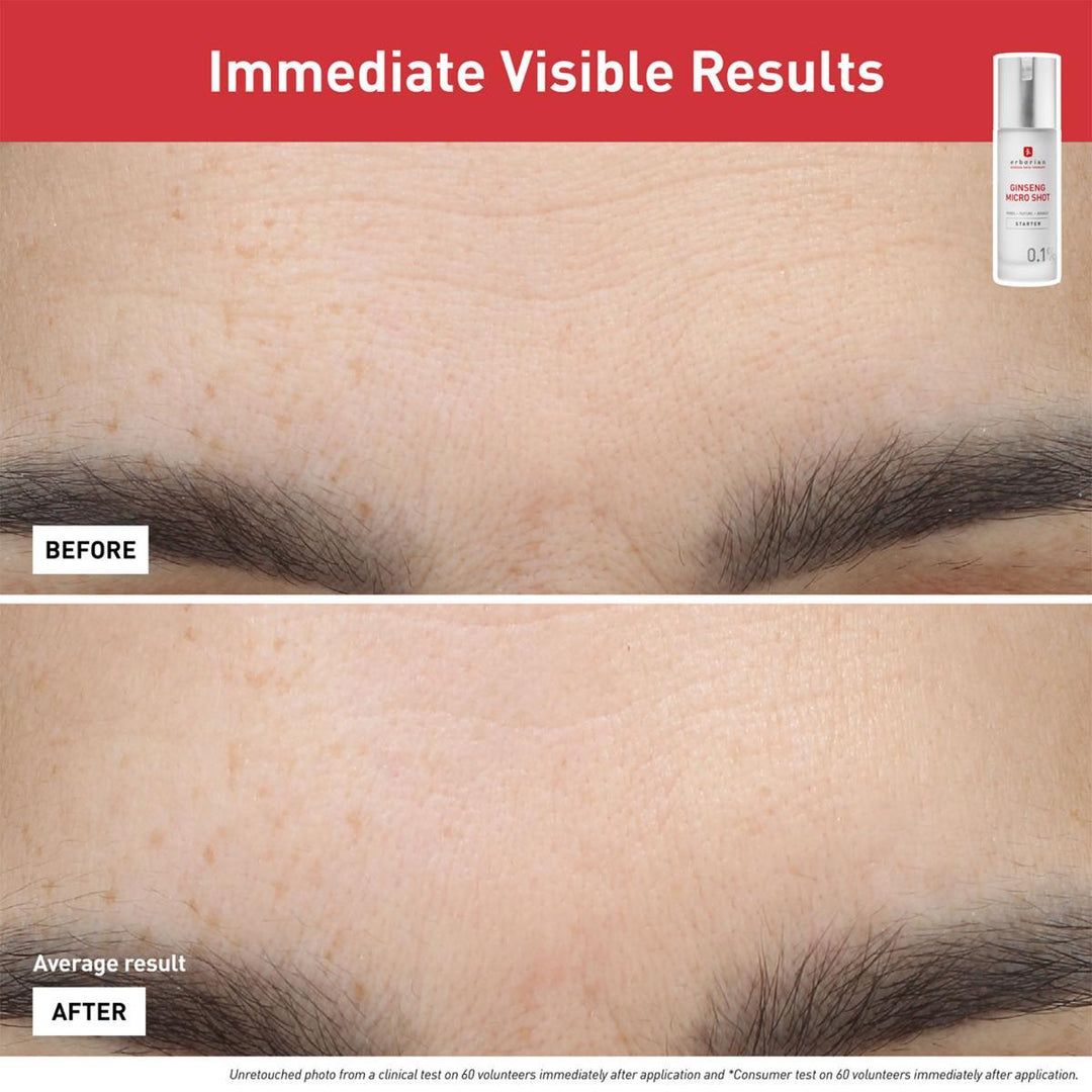 Ginseng Micro Shot Starter 0.1% Serum
