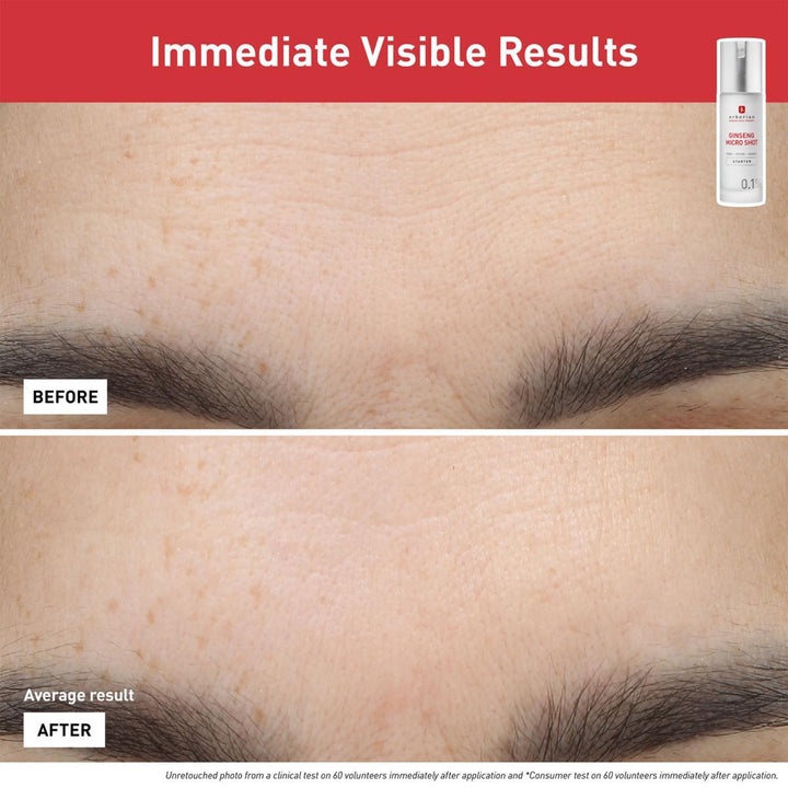 Ginseng Micro Shot Starter 0.1% Serum
