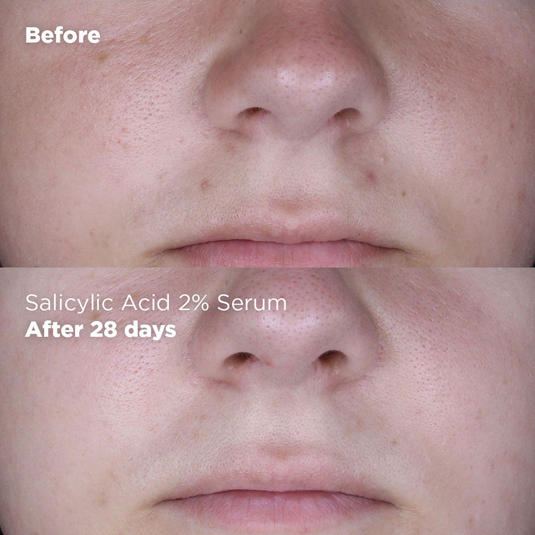 Skin Republic Salicylic Acid 2% Serum