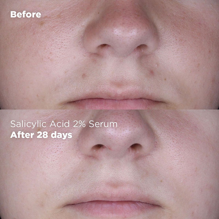Skin Republic Salicylic Acid 2% Serum