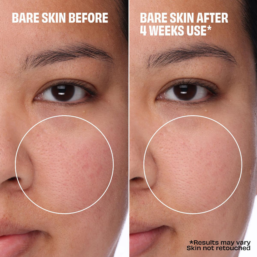 The POREfessional Foundation