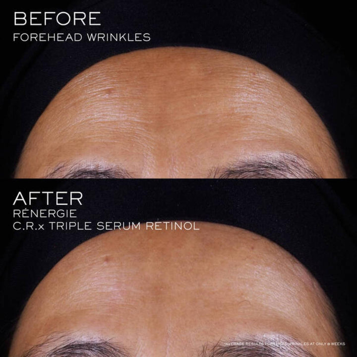 Rénergie C.R.x. Triple Serum Retinol
