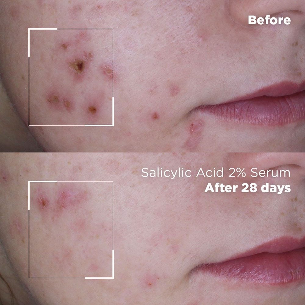 Skin Logic Serum 30ml