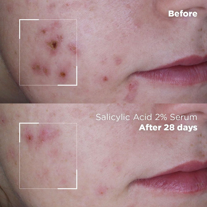 Skin Logic Serum 30ml