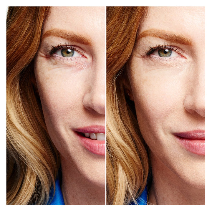 Boi-ing Hydrating Concealer