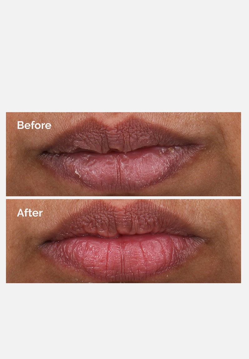 PHA 5% Exfoliating Lip Serum | The Ordinary