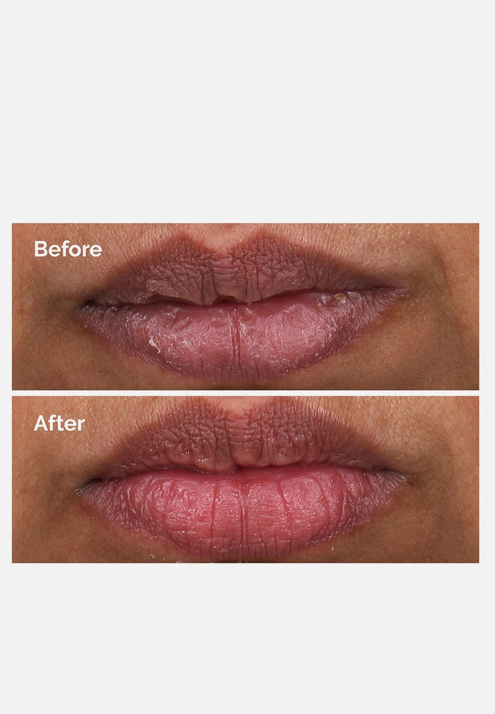 PHA 5% Exfoliating Lip Serum | The Ordinary